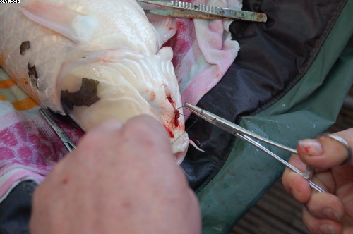 stitching up the incision